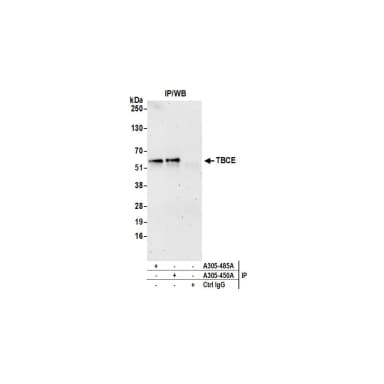Rabbit anti-TBCE Antibody, Affinity Purified