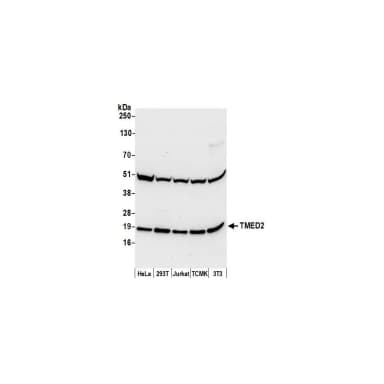 Rabbit anti-TMED2 Antibody, Affinity Purified