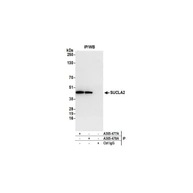 Rabbit anti-SUCLA2 Antibody, Affinity Purified
