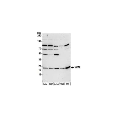 Rabbit anti-YKT6 Antibody, Affinity Purified