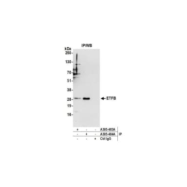 Rabbit anti-ETFB Antibody, Affinity Purified