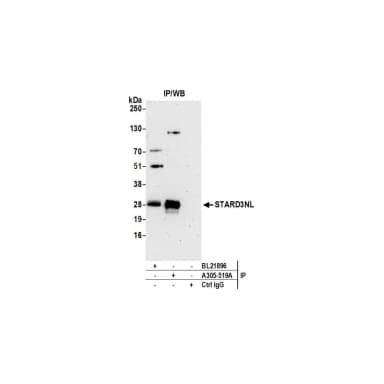 Rabbit anti-STARD3NL Antibody, Affinity Purified
