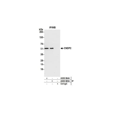 Rabbit anti-CNDP2 Antibody, Affinity Purified