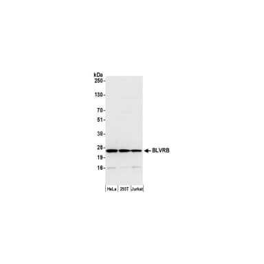 Rabbit antiVRB/Biliverdin reductase B Antibody, Affinity Purified