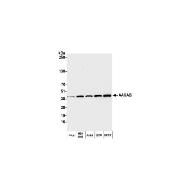 Rabbit anti-AAGAB Antibody, Affinity Purified