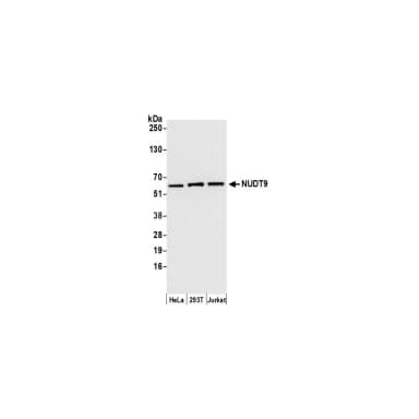Rabbit anti-NUDT9 Antibody, Affinity Purified
