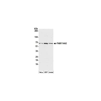 Rabbit anti-FAM114A2 Antibody, Affinity Purified