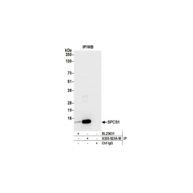 Rabbit anti-SPCS1 Antibody, Affinity Purified