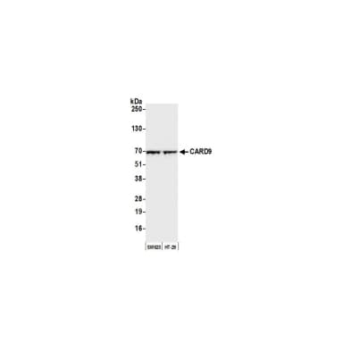 Rabbit anti-CARD9 Antibody, Affinity Purified