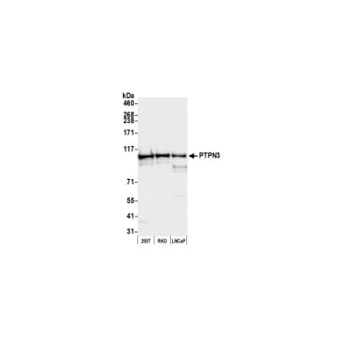 Rabbit anti-PTPN3 Antibody, Affinity Purified