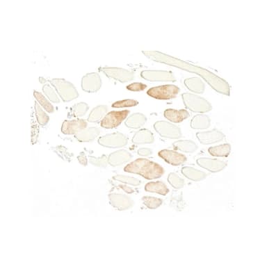 Mouse anti-Skeletal Troponin I Monoclonal Antibody [FI-23]