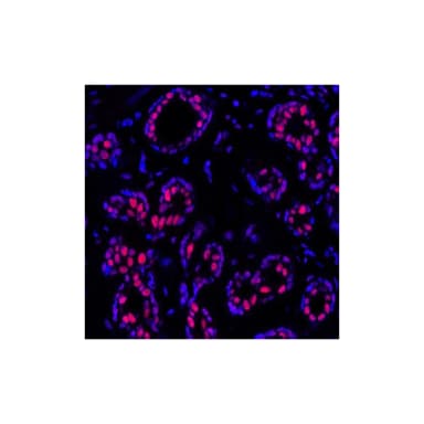 Rabbit anti-PBRM1 Recombinant Monoclonal Antibody [BL-39-2C3]