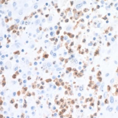Rabbit anti-Arginase 1 Recombinant Monoclonal Antibody [BLR036F]