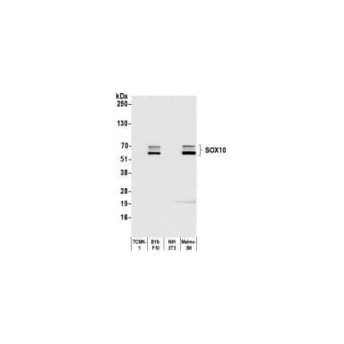 Rabbit anti-SOX10 Recombinant Monoclonal Antibody [BLR080G]