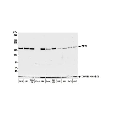 Rabbit anti-ZEB1 Recombinant Monoclonal Antibody [BLR102H]