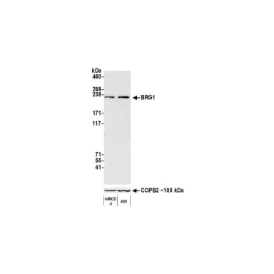 Rabbit anti-BRG1 Recombinant Monoclonal Antibody [BLR106H]