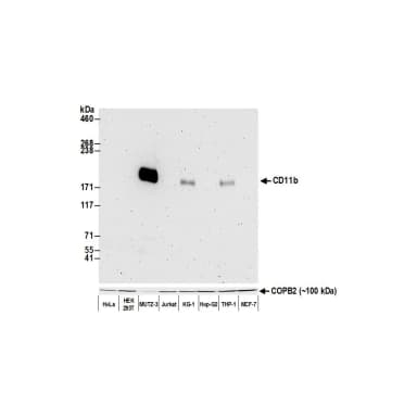 Rabbit anti-CD11b Recombinant Monoclonal Antibody [BLR107H]