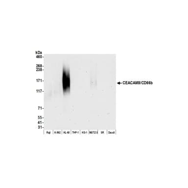 Rabbit anti-CEACAM8/CD66b Recombinant Monoclonal Antibody [BLR111H]