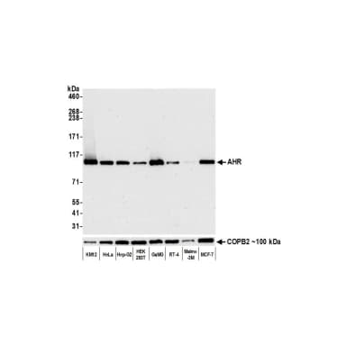 Rabbit anti-AHR Recombinant Monoclonal Antibody [BLR118H]