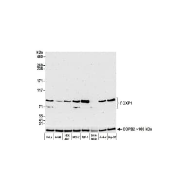 Rabbit anti-FOXP1 Recombinant Monoclonal Antibody [BLR134H]