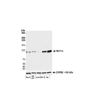 Rabbit anti-Bcl11a Recombinant Monoclonal Antibody [BLR151J]