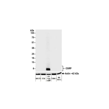 Rabbit anti-CGRP Recombinant Monoclonal Antibody [BLR169J]