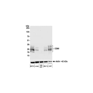 Rabbit anti-CD69 Recombinant Monoclonal Antibody [BLR170J]