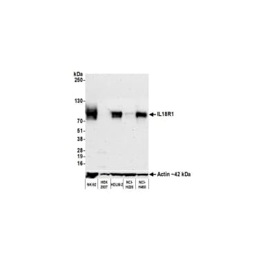 Rabbit anti-IL18R1 Recombinant Monoclonal Antibody [BLR172J]