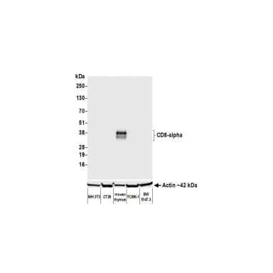 Rabbit anti-CD8 alpha Recombinant Monoclonal Antibody [BLR173J]