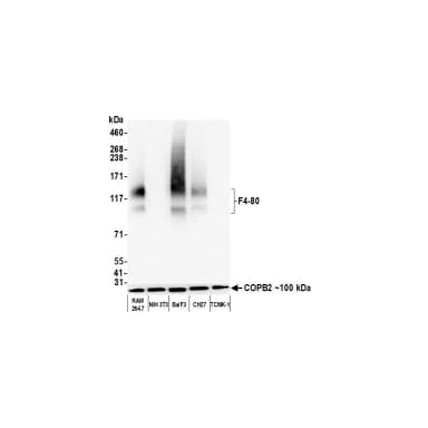 Rabbit anti-F4/80 Recombinant Monoclonal Antibody [BLR209K]