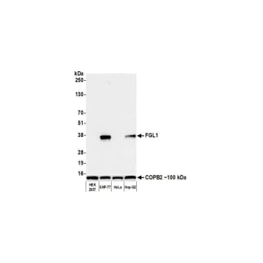 Rabbit anti-Hepassocin/FGL1 Recombinant Monoclonal Antibody [BLR210K]