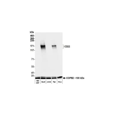 Rabbit anti-CD22 Recombinant Monoclonal Antibody [BLR214K]