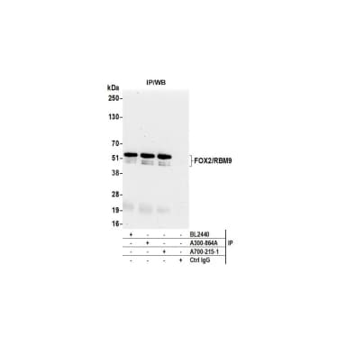 Rabbit anti-FOX2/RBM9 Recombinant Monoclonal Antibody [BLR215K]