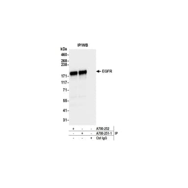 Rabbit anti-EGFR Recombinant Monoclonal Antibody [BLR251L]