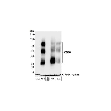 Rabbit anti-CD70 Recombinant Monoclonal Antibody [BLR266L]