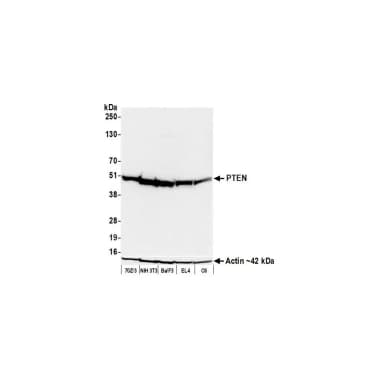 Rabbit anti-PTEN Recombinant Monoclonal Antibody [BLR270L]