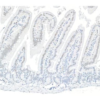 Rabbit anti-ARID1B Recombinant Monoclonal Antibody [BLR291L]