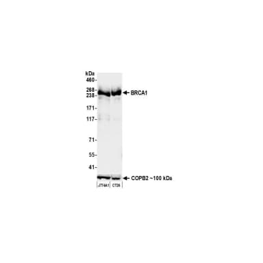 Rabbit anti-BRCA1 Recombinant Monoclonal Antibody [BLR319M]
