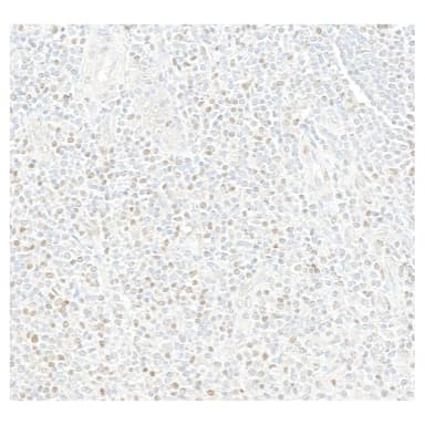 Rabbit anti-MEF2C Recombinant Monoclonal Antibody [BLR327M]