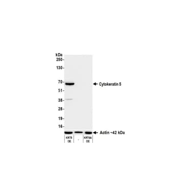 Rabbit anti-Cytokeratin 5 Recombinant Monoclonal Antibody [BLR332M]