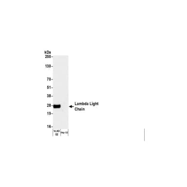 Rabbit anti-Human Lambda Light Chain Antibody, Affinity Purified