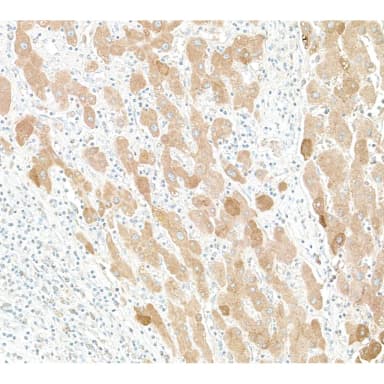 Goat anti-Human C-Reactive Protein (CRP) Antibody Affinity Purified