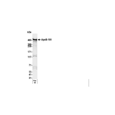 Goat anti-Human Apo B-100 Antibody FITC Conjugated
