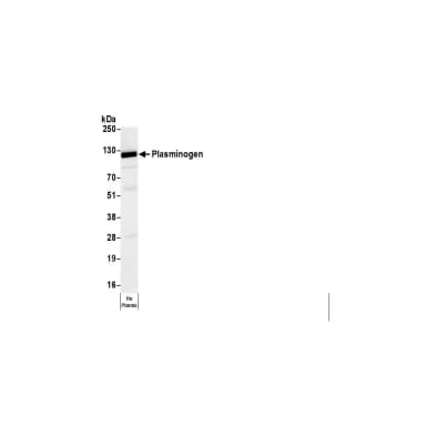Goat anti-Human Plasminogen Affinity Purified