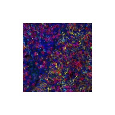 T Cell Maturation PathPlex® Panel (CD8 alpha, Cytokeratin, CD45RO, CD4, FOXP3)