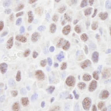 Rabbit anti-HDAC2 IHC Antibody, Affinity Purified
