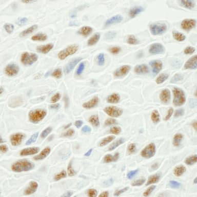 Rabbit anti-Phospho XRCC1 (S461) IHC Antibody, Affinity Purified