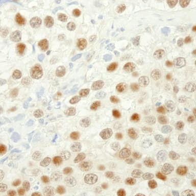 Goat anti-MSH6 IHC Antibody, Affinity Purified