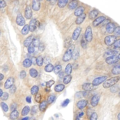 Rabbit anti-BID IHC Antibody, Affinity Purified