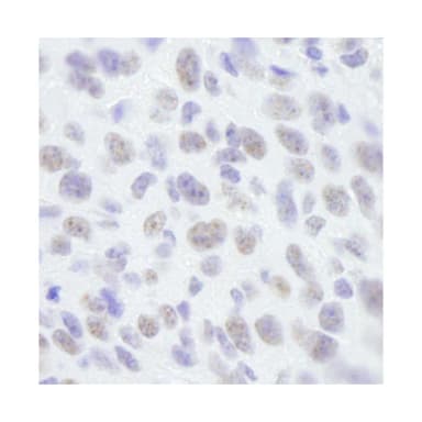 Rabbit anti-SAFB1 IHC Antibody, Affinity Purified
